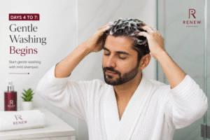 Man gently washing his hair with mild shampoo during days 4 to 7 after a hair transplant