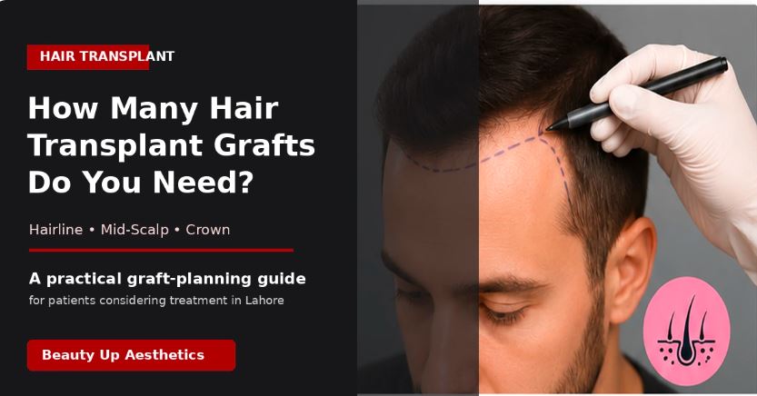How-Many-Grafts-Do-You-Need-for-a-Hair-Transplant