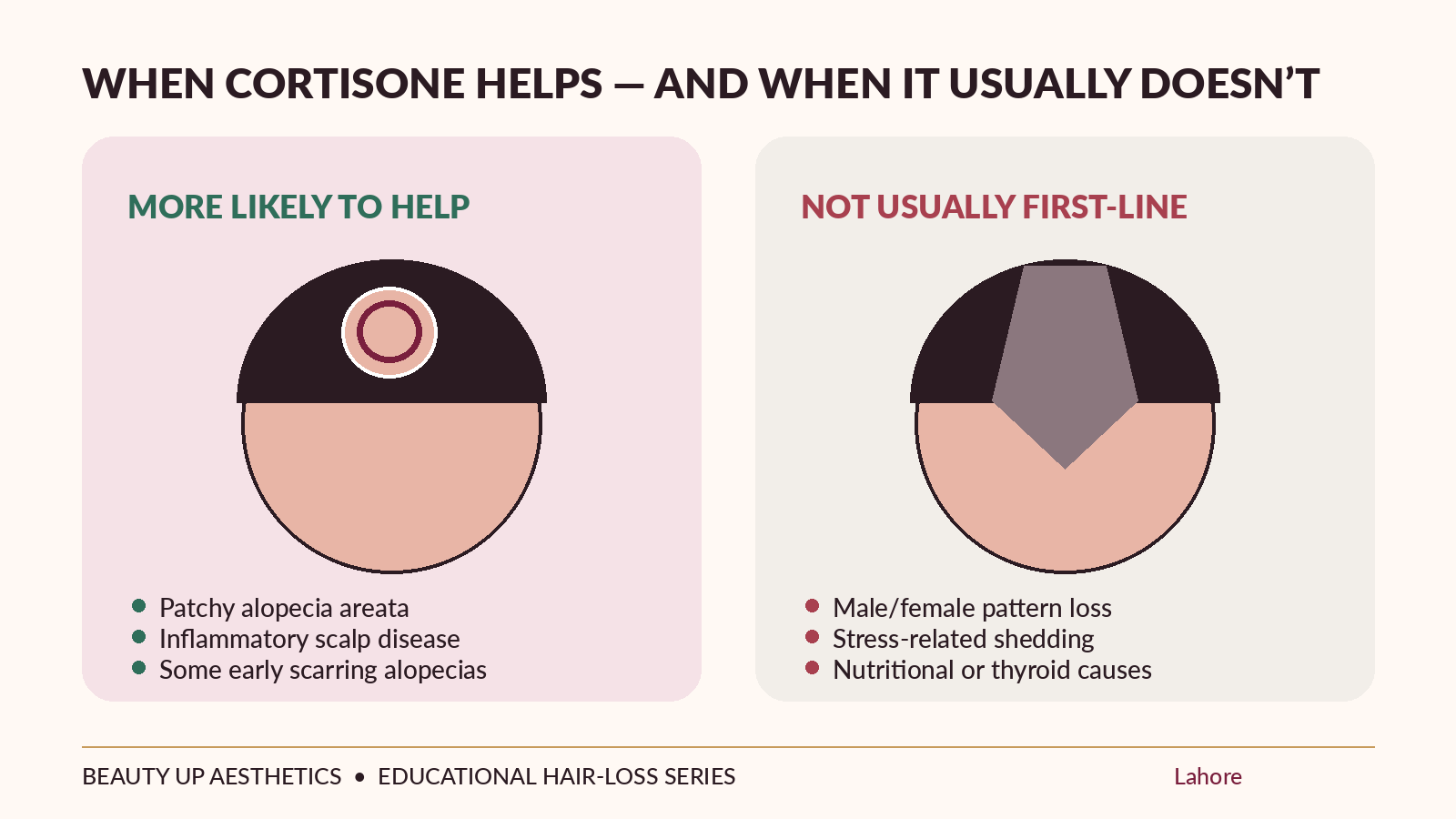 Comparison of alopecia areata and pattern hair loss showing when corticosteroids are more likely or less likely to help